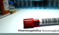 Prima terapia genica contro l&rsquo;emofilia B somministrata in Italia