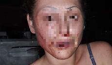 30enne aggredita: «Ho denunciato il mio aggressore»