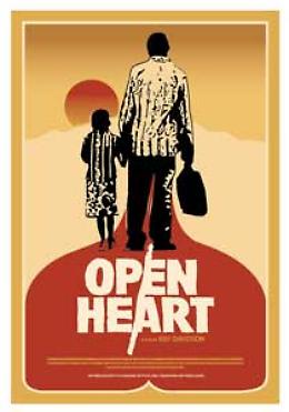 Open heart