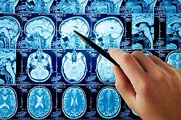 'Stop all'ictus': oggi dalle 9 alle 18 
Open day nell'atrio dell'ospedale