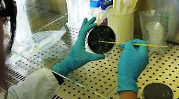 Legionella nelle condutture, disinfestazione in un motel