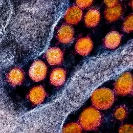 Coronavirus, la stima degli esperti: probabile picco dei casi fra il 2 e il 12 aprile