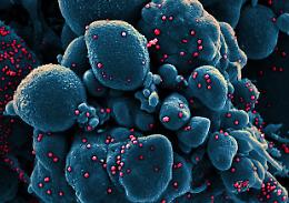 Coronavirus: Diasorin, entro aprile test su anticorpi