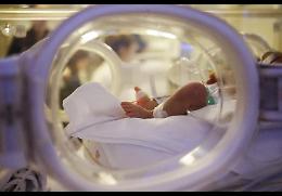  Fatta nascere neonata con cuore fuori da torace