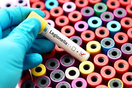 Casi legionella a Busto Arsizio, Ats e Asst al lavoro su protocolli sicurezza