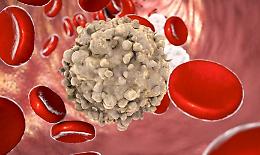 Leucemia, con cellule laboratorio scomparsa in 86% malati