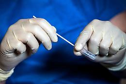 In Lombardia positivi 2 tamponi su 10