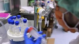 Covid: 200 milioni di dosi vaccino Oxford per fine anno 