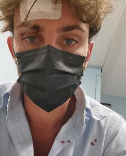 «Io, aggredito senza motivo. Volevano solo picchiare»