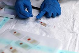Primo caso vaiolo scimmie isolato a ospedale Civile Brescia