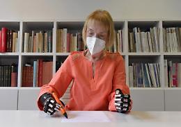 Donna ritrova uso delle mani con protesi ultima generazione