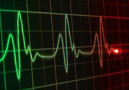 Cuore, con sonno irregolare cresce il rischio aterosclerosi