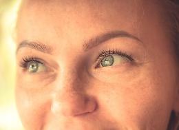 Lupus, nel 90% dei casi colpisce le donne
