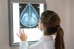 Tumore al seno, una nuova cura riduce del 25% il rischio di recidive
