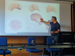 Sul cranio arcaico 'Acamar' è iniziata la campionatura