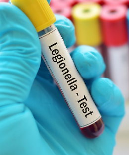 Stroncato dalla legionella: il batterio nei tubi di casa