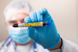 Febbre Dengue, registrato un primo episodio anche nella nostra provincia. Nessun allarme