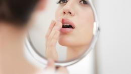 Herpes: il fastidio che può rovinare l’estate