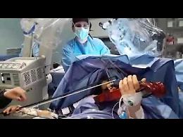 VIDEO Ragazza di 23 anni operata al cervello mentre suona il violino