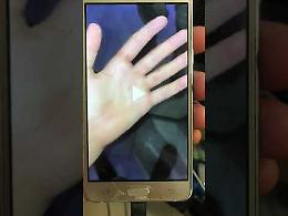 VIDEO Le mani ferite riprese da un aggressore