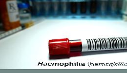 Prima terapia genica contro l’emofilia B somministrata in Italia