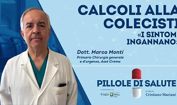 Calcoli alla colecisti: «I sintomi ingannano»