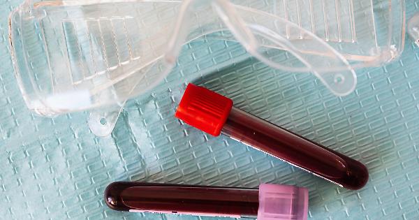 Ett blodprov för att diagnostisera 50 olika typer av cancer