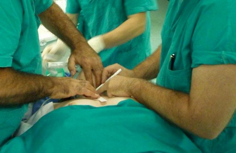 Un intervento chirurgico