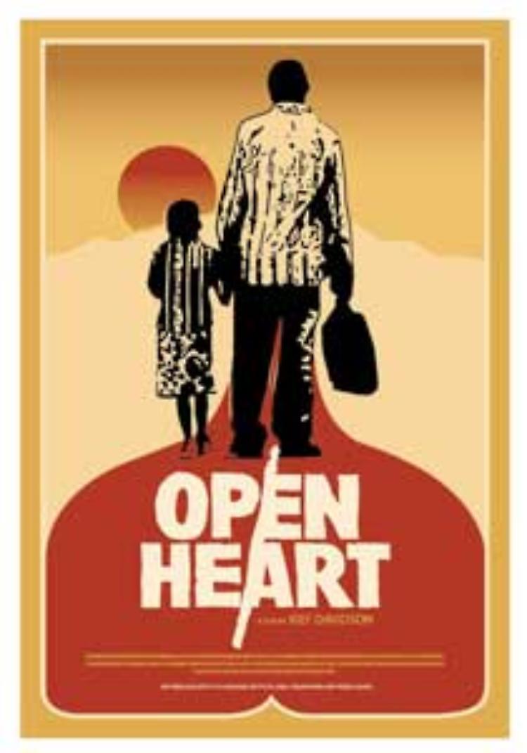 Open heart