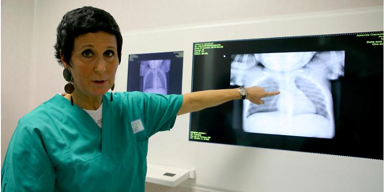 Bimba rischia il soffocamento, salvata dalla pneumologa  Majori