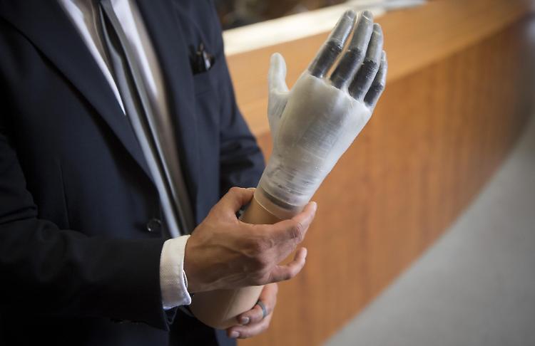 Mano bionica, piega le dita come la vera