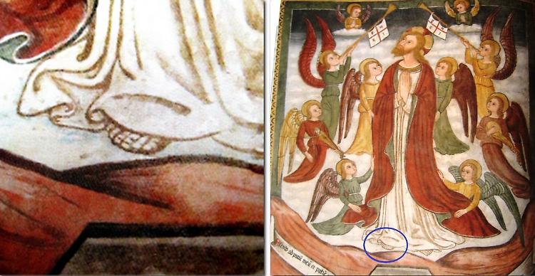 Esadattilia, altro caso svelato da Manfredi 