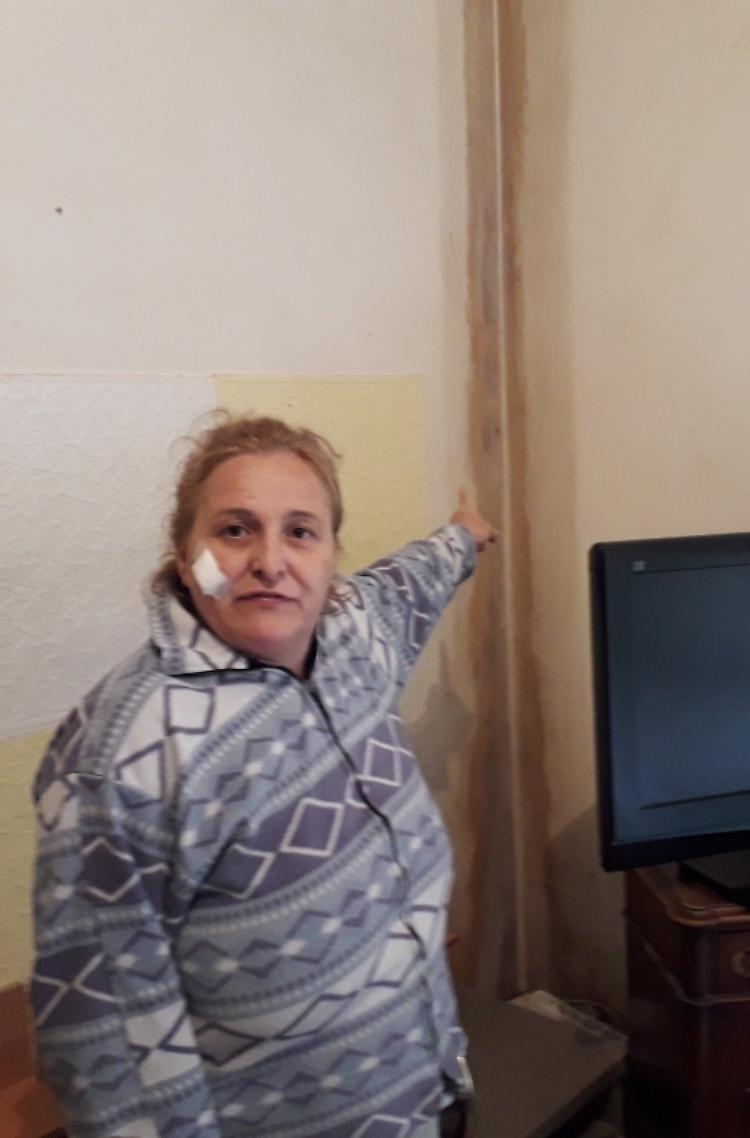 Case comunali, "Sono ammalata e vivo tra la muffa"