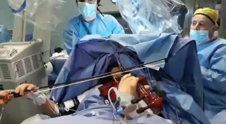 Musicista operata al cervello mentre suona violino