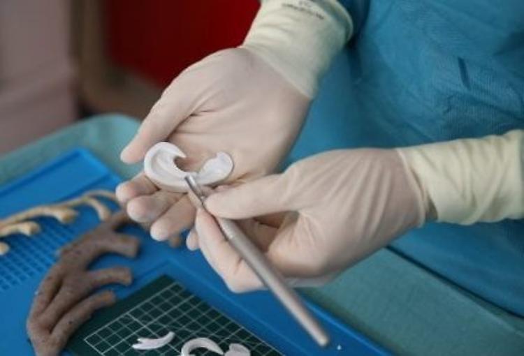 Bimbo nato senza orecchie, uno ricostruito in 3D