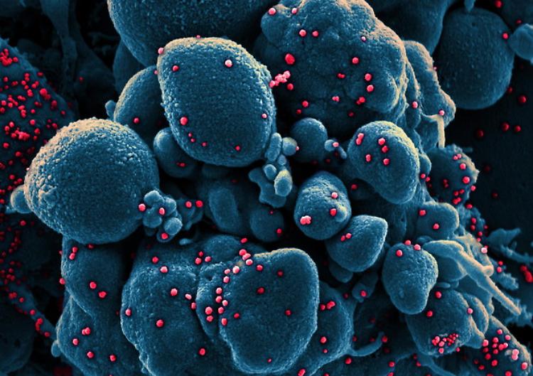 Coronavirus: Diasorin, entro aprile test su anticorpi