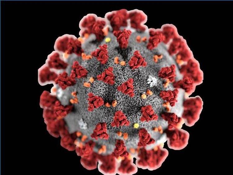 Coronavirus, America Latina oltre 75 mila morti