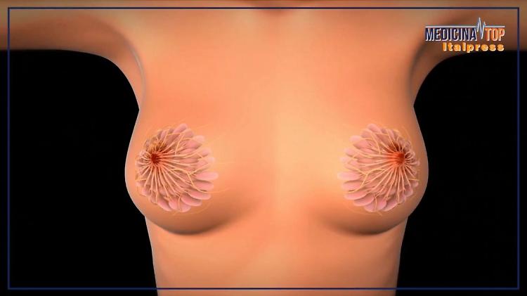 Tumore al seno, la sopravvivenza a 5 anni dalla diagnosi è dell'88%