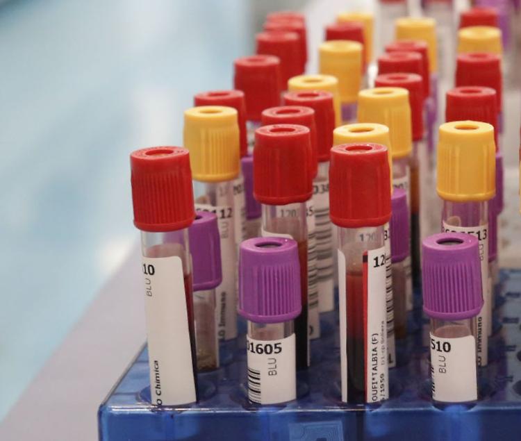 Botulino, dal 2001 al 2024 segnalati 1.276 casi in Italia