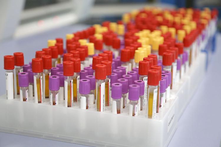 Botulino, Meo (Polo Viaggiatore Artemisia Lab) "Attenzione alle...