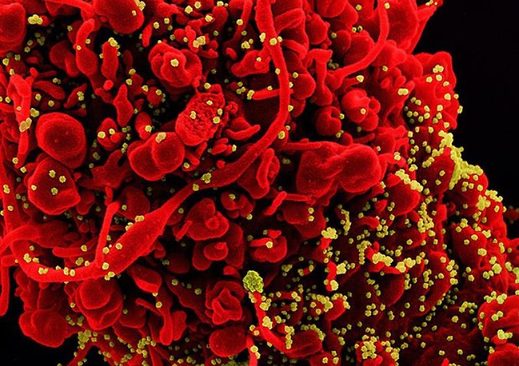 Scoperti anticorpi anti-Covid grazie a una tecnica italiana