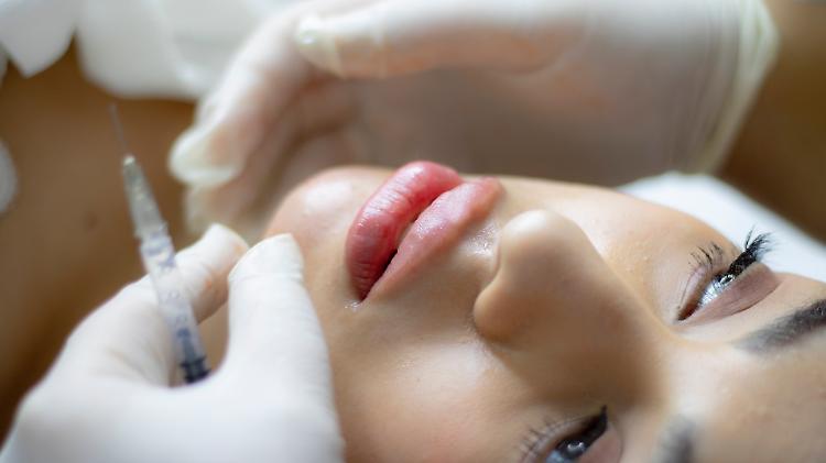 Generazione Botox, l'Inghilterra vieta i filler ai minorenni. In Italia situazione sotto controllo