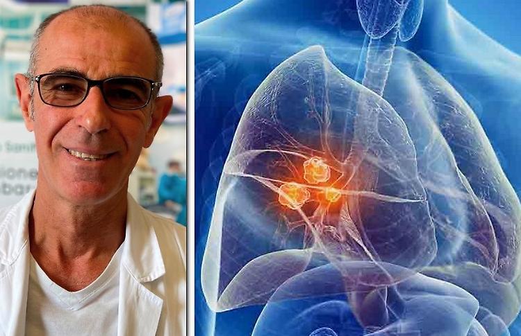 Malattie rare polmonari: a Cremona il congresso degli specialisti
