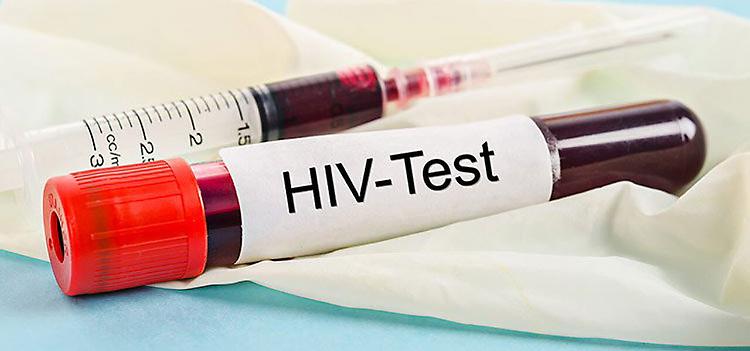 Contagiata da Hiv accusa l'ex compagno sieropositivo: «In quattro anni non me lo ha mai detto»