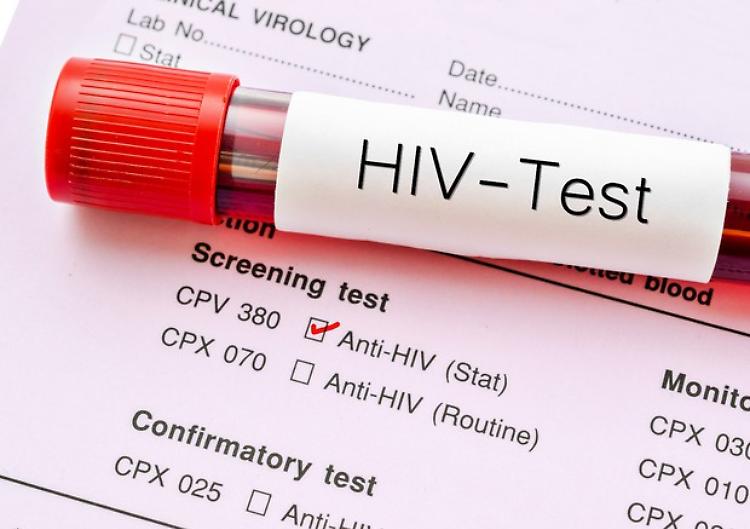 "Combatti l'Hiv, non le persone con Hiv!"