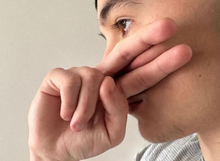 ‘Cicatrice francese’, la nuova sfida su Tik Tok: nelle classi scatta l’allerta 