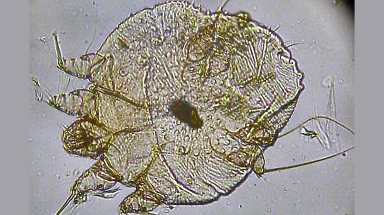 Focolaio di scabbia a Malta, i medici: «Siamo a corto di cure»