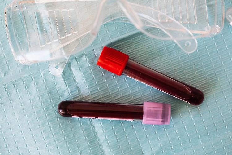 Un esame del sangue per diagnosticare 50 tipi diversi di cancro