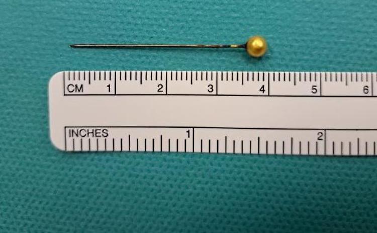 Sarta ingerisce uno spillo di 4 centimetri: salvata dall'équipe della dottoressa Majori