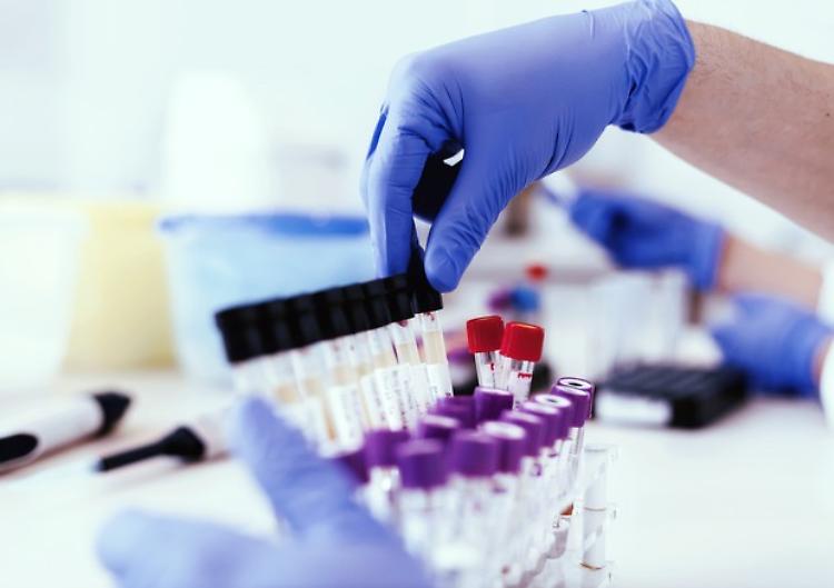 Rifiuta il test sull'uso delle droghe, denunciato 29enne: via la patente